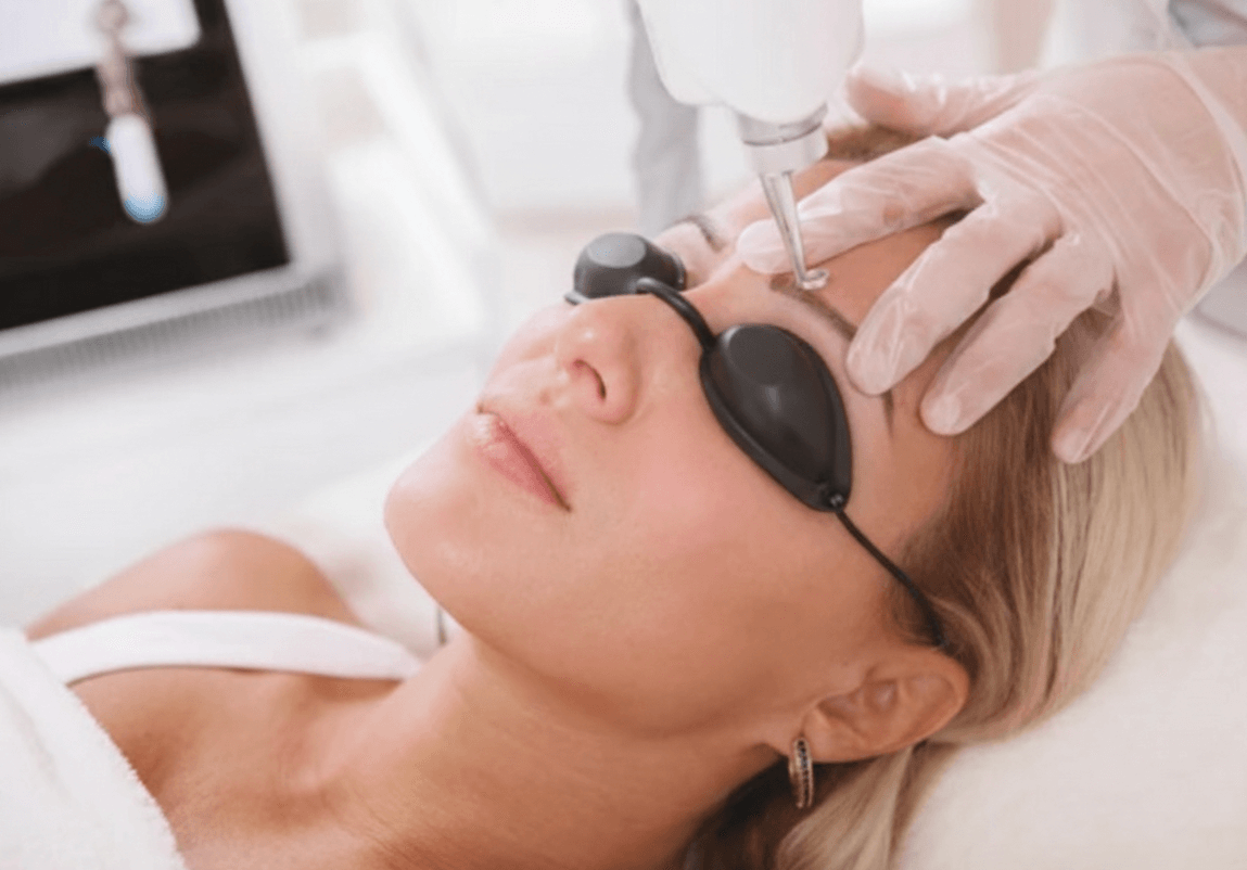Fjerning av Permanent Makeup med Laser